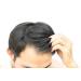 Hair Growth Conditioner - Stimulating Formula for Hair Loss Treatment | Redensyl vs Minoxidil | 250ml - Buy Online on GoSupps.com