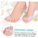 Bunion Corrector Kit with Toe Straighteners and Gel Spacers - Foot Pain Relief for Athletes and Dancers - Buy Online on GoSupps.com