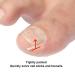 60+2 Pack Ingrown Toenail Treatment Set - Includes Corrector Strips, Lifter, and Nail Clipper - Professional Ingrown Toenail Correction Tool - Buy Online on GoSupps.com