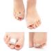 Carolhome 5 Pack Toe Wraps Splints - Toe Protectors & Correctors for Crooked and Overlapping Toes - Toe Spacer Bunion Corrector - Men and Women - Buy Online on GoSupps.com