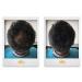 Alfy Hair Building Fibers for Thinning Hair - Dark Brown 12g | Boost Volume & Density - Buy Online on GoSupps.com