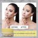 MIYUU Anti Vitiligo Cream | Effective Treatment for Vitiligo White Patches & Skin Discoloration | Scar Removal | 80g - Buy Online on GoSupps.com