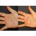 FixMySkin Healing Body Balm 0.5 oz - Fragrance-Free Moisturizer for Dry Skin and Eczema Relief - Buy Online on GoSupps.com