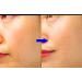 Buy K-Beauty Anti-Aging Ampoule Serum - 85% Human Stem Cell & 10% PDRN - 12 Vials (120ml) - Visible Repair & Rejuvenation - Buy Online on GoSupps.com