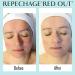 Repechage Red Out Serum - Redness Reducing Skin Care with Seaweed & Silver | Calming Relief for Sensitive Skin & Rosacea | 1 fl oz - Buy Online on GoSupps.com