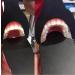 Buy Orthodontic Photographic Glass Mirror Set - 6 Pcs Intraoral Dental Contrast Board for Best Photography Results - Buy Online on GoSupps.com