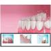 Portable Cordless Water Flosser - Rechargeable Dental Oral Irrigator for Home & Travel | Powerful Waterproof Teeth Cleaner - Buy Online on GoSupps.com