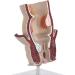 Hemorrhoid Model Model of Human Rectal Disease Hemorrhoids Internal and External Hemorrhoids Pathological Model Communication - Buy Online on GoSupps.com