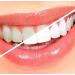 Teeth Whitening Kit: (10) Gels, (2) Trays, (1) Blue White LED Light - Easy At-Home Whitening for Brighter Smile & Fast Results - Buy Online on GoSupps.com