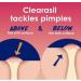 Salicylic Acid Rapid Rescue Acne Pads - 90 Count | Clearasil Deep Treatment for Acne | Fast International Shipping - Buy Online on GoSupps.com