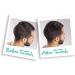 Hair Building Fibres for Thinning Hair (Brown) - Buy Online on GoSupps.com