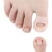 Ingrown Toenail Corrector Sleeves 4 Pairs Elastic Silicone Ingrown Toenail Correction Tool Thick Paronychia Treatment Corrector Big Toe Sleeves Toe Nail Healing Care Protector for Keep Nail Healthy - Buy Online on GoSupps.com