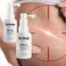 Synergy Heal Skin Care Serum - 1.7fl oz for Stretch Marks Acne & Scars - Best Facial & Body Treatment - Buy Online on GoSupps.com