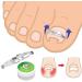 ANGGREK Ingrown Toenail Corrector | Stainless Steel Tool for Pain Relief & Correction | Effective Ingrown Toenail Treatment - Buy Online on GoSupps.com