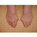 Bochikun Hallux Valgus Aid | Bunion Corrector & Supporter - Day & Night Pain Relief Splint Size S (Left) - International Shipping Available - Buy Online on GoSupps.com
