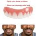 Yangyangda Adjustable Snap-On Tooth Replacement | Temporary Tooth Veneers for Confident Smiles - Upper Teeth Restoration - Buy Online on GoSupps.com