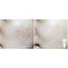 Vegan Beauty Eggplant Daily BHA Moisturizing Cream | Salicylic Acid Anti-Acne Treatment | Natural Moisturizer 1.7 fl. oz - BONAJOUR - Buy Online on GoSupps.com