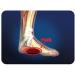 Pro-Tec Athletics Arch Pro-Tec - Premium Plantar Fasciitis Arch Support Pair - Buy Online on GoSupps.com
