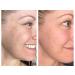 Su-Skin Retinol Serum 4% - Anti-Aging Solution for Dark Spots & Wrinkles | Shop Internationally - Buy Online on GoSupps.com
