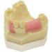 Denture Repair Resin - Medical Training Aid for Dental Education & Planting Training - Buy Online on GoSupps.com