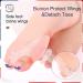 Bunion Relief for Kids - Gel Toe Separators with Loops for Overlapping Toes & Bunion Corrector Pads - Buy Online on GoSupps.com