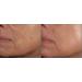 Su-Skin Growth Factor Hyaluronic Acid Serum - Anti Aging with BIO Placenta for Firming Hydration | International Shipping - Buy Online on GoSupps.com
