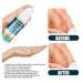 Advanced Scar Gel for Old Scars, Stretch Marks, and Burns - Effective Skin Repair Solution - Buy Online on GoSupps.com