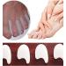 PEDIMEND Gel Toe Separator (5PAIR - 10PCS) | Toe Straightener & Alignment | Absorbs Pressure & Friction | Unisex | Foot Care - Buy Online on GoSupps.com