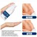 30g Advanced Silicone Scar Gel Cream for C-Section, Tummy Tuck, Stretch Marks, Keloids & Scratches - Buy Online on GoSupps.com