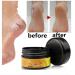 Premium Foot Cream Ointment for Cornea Treatment Moisturizing Balm for Dry Feet - Buy Online on GoSupps.com