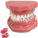 BAUR Dental Organ Model - Orthodontic Teeth Model for Dentists | Metal & Ceramic Oral Demonstration - Buy Online on GoSupps.com
