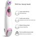 NCRD Blackhead Remover Vacuum USB Rechargeable Facial Pore Cleanser Electric Acne Extractor with 4 Probes - Buy Online on GoSupps.com
