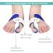 Bunion Corrector & Relief Protector Kit - Toe Spacers & Straightener Splint for Hallux Valgus, Tailors Bunion, Hammer Toe - 2 PCS - Buy Online on GoSupps.com