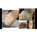  BEROZA Skin Lightening Cream for Dark Spots on Face Underarms Neck and Groin Women's Underarm Whitening Cream Cream to Lighten Underarms and Intimate Areas 50ml Whitening Cream - Buy Online on GoSupps.com