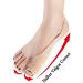 Pedimend Silicone Gel Toe Spreader for Hallux Valgus Relief | Big Foot Alignment & Discomfort Reduction | International Shipping Available - Buy Online on GoSupps.com