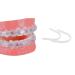 Mouthguard for braces - replaces orthodontic wax - lip pads for orthodontics - DeltaDent