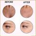 Wrinkles Patches Chest Wrinkle Pads Anti-Wrinkle Reusable Silicone Patches Facial Wrinkle Remover Strips Wrinkle Patches for Face Neck and Chest (B) - Buy Online on GoSupps.com