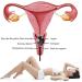 FANGO Yoni Egg - Natural Bloodstone Massage Egg with Wooden Base for Pelvic Floor Exercises - Buy Online on GoSupps.com