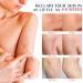 Silicone Scar Sheets 4 Pack for Surgery Scars Treatment - 5.7x1.57 Inch Tape Strips for Keloid, C-Section, Tummy Tuck, Stretch Marks - Surgical Scar Healing Cream Gel Patch Pad - Buy Online on GoSupps.com