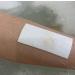 25 Pack Sterile Waterproof Island Dressing, Latex Free with Transparent Border - 6cm x 7cm, 100% Cotton Absorbent Pad - Buy Online on GoSupps.com