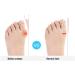 Artocct Bunion Corrector | Pain Relief Toe Separator Kit | Orthopedic Bunion Splint for Hallux Valgus & Hammer Toe Support - Buy Online on GoSupps.com
