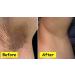 TOWELL Crema Aclaradora | Elimina Manchas en Cara Axilas Cuello y Entrepierna - Env o Internacional Disponibles - Buy Online on GoSupps.com