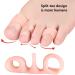 BodyFEET Aligners Kit - Posture Correction & Pain Relief for Hallux Valgus | Silicone Toe Pads & Separator for Small Toes (Black) - Buy Online on GoSupps.com