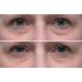 Dr. Denese HydroShield Eye Emulsion - Hydrating Eye Cream with Botanical Stem Cells & Ceramides for Wrinkle Reduction - 1oz - Buy Online on GoSupps.com