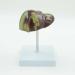 Pathological Liver Model Gallstone Model Fatty Liver Educational Training Aid - 11 * 11 * 15CM - Buy Online on GoSupps.com