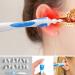 Q-Grips Ear Cleaner Ear Wax Removal Tool Kit - Spiral Tip Picker for Perfect Ear Cleaning - Buy Online on GoSupps.com