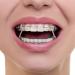 Buy SmileSupplies Colour Elastic - 100 Pcs + Free Placer | International Shipping Available - Buy Online on GoSupps.com