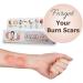 Boomers Scar Gel for Acne & Sports Injury - All Skin Types (15 GM, Pack of 3) - Buy Online on GoSupps.com