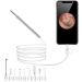 LUYILA Wireless Endoscope Ear Wax Removal Tool 3.9mm Camera - Earwax Remover and Cleaner - Buy Online on GoSupps.com