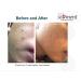 Korean Cosmetics Serment Enzyme Acne Face Wash Powder | Exfoliating Hypoallergenic Cleanser with Collagen Boost & Vitamin E for Sensitive Skin | Pore Purifying Acne Prevention - Buy Online on GoSupps.com